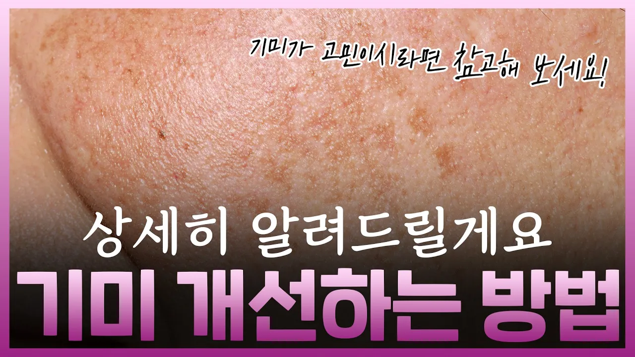 잡티? 기미? 치료, 개선방법 알려드려요!|합정 피부과