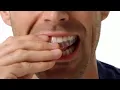 Local customers left in limbo after SmileDirectClub shuts down with no word on potential refunds