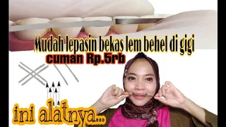tutorial bersihin bekas lem behel di gigi behelgigi nenkmhel08