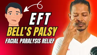 Bell's Palsy Stress Relief with Simple EFT Tapping