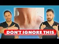 How to FIX CREPEY SKIN The Ultimate Dermatologist Guide