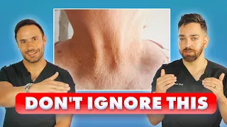 How to FIX CREPEY SKIN The Ultimate Dermatologist Guide