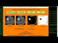 Python Code On Brain Tumor Detection Using Image Processing full Source Code IEEE Based Projects