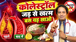 कोलेस्ट्रॉल जड़ से खत्म बस यह खाओ || कोलेस्ट्रॉल को पिघला देंगी ये चीजें || Cholesterol Control Food