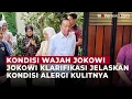 Download Lagu Wajah Memerah dan Membengkak, Jokowi: Saya Baik-baik Saja | OneNews Update