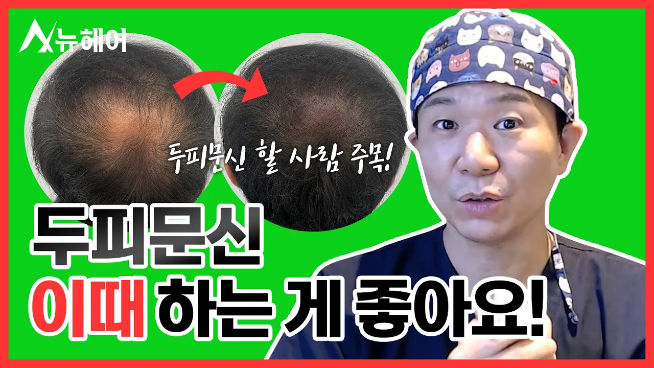 두피문신 시술받기 좋은 나이? #SMPㅣ뉴헤어