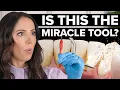 Do You REALLY Need A Teeth Scaling