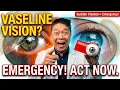Vaseline on Your Glasses The Truth About Retinal Tears