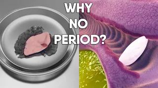 She Never Had a Period. Here's Why! | Original 3D Animation (Not AI-Generated)  #period #womanhealth