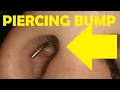 how to get rid of a piercing bump inside nose