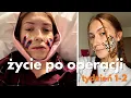 Lagu życie po operacji dwuszczękowej | weekly vlog