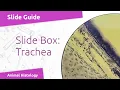 Virtual Slide Respiratory System - Trachea