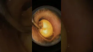 هل شاهدت كيفية تنظيف الاذن من الداخل  هل شاهدت كيفية تنظيف الاذن من الداخل