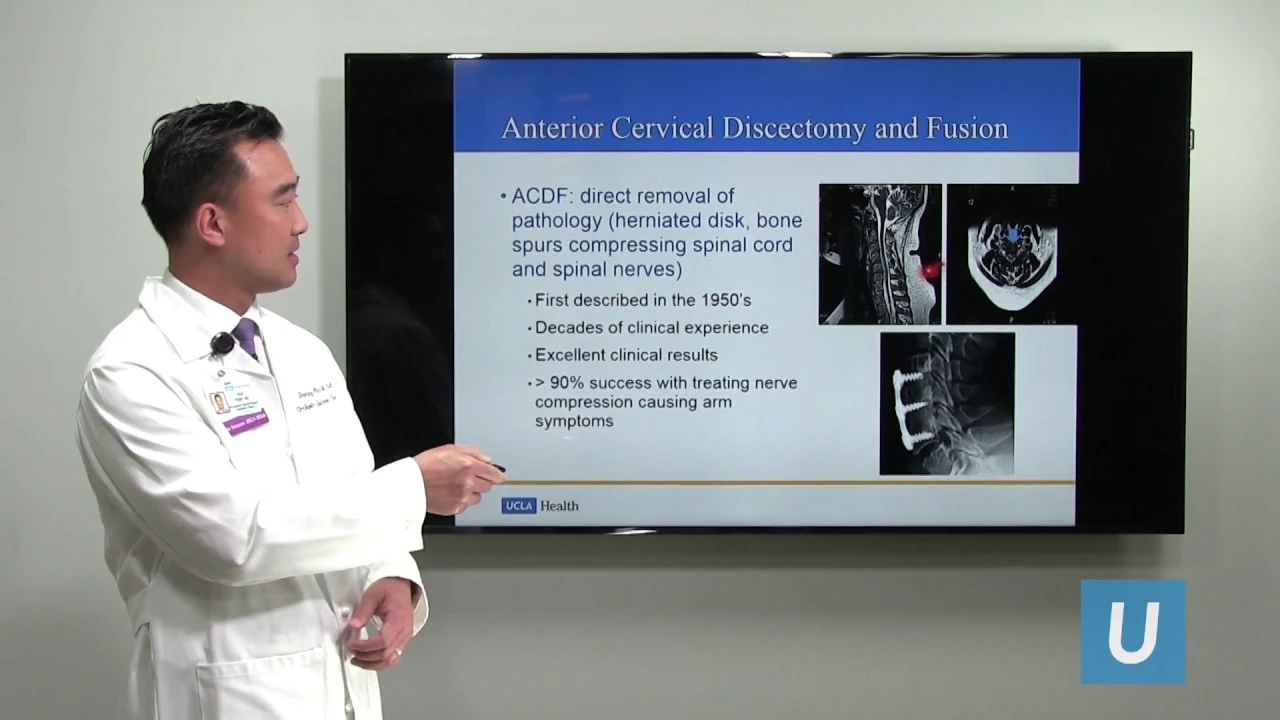 A quick, cohesive explanation of lumbar radiculopathy for Step 1. In this video we discuss the anato. 