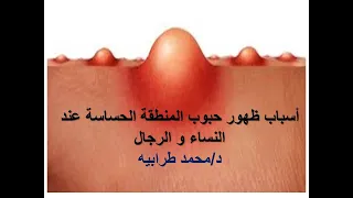 أسباب ظهور حبوب المنطقة الحساسة عند النساء و الرجال    دكتور محمد طرابيه دندنها