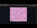 Ovary Cancer Detection System using Deep Learning AI Project