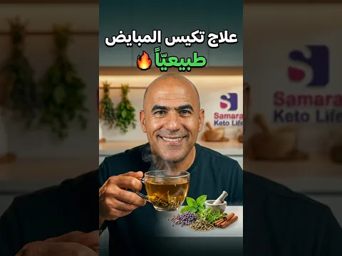 علاج تكيس المبايض طبيعا 🔥