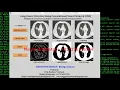 Lung Cancer Detection Using Python Opencv Lung Nodule Classification Using Machine Learning Code