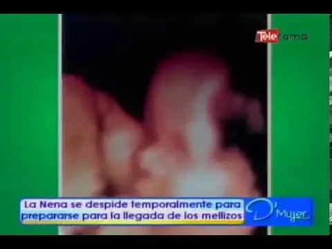 La Nena se despide temporalmente para prepararse para la llegada de los mellizos