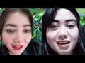Lagu Teh Novie PK an dengan mantan pasien...Alhamdulillah...Desy udah sembuh total....