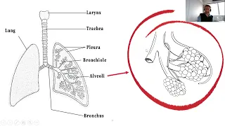 4 A Basic guide to NIV in the acute setting