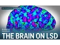 Here s what happens to the human brain on LSD