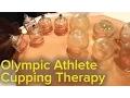 Chinese Cupping Therapy - Michael Phelps Olympics Bruise Mystery Solved Pain Relief and Therapy