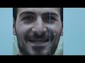 Are Dental Implants One-Size-Fits-All ClearChoice Prosthodontists Reveal the Truth