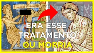 9 Práticas Nojentas e Agonizantes na Medicina da Idade Média | Era Medieval