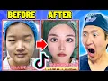 Plastic Surgeon Reacts to OUTRAGEOUS Viral TikTok s