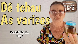 Acabe com as varizes com essa receitinha da vó Dalva.