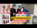 Download Lagu Big Transformation ni Yaya Jina Rhinoplasty , Blepharoplasty \u0026 chin augmentation ,
