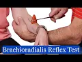How to Best Test the Brachioradialis Reflex C6