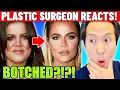 KHLOE KARDASHIAN Cosmetic Surgery Transformation