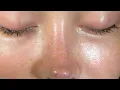 Hyderated and clearest skin