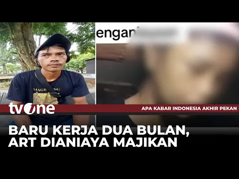 Kondisi Terkini dari ART Asal Banyumas yang Diduga Dianiaya Majikan