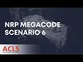 NRP Megacode Scenario 6 ACLS Certification Association