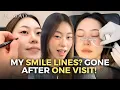 How I Got Rid of My Smile Lines Naturally Non-Surgical in Korea