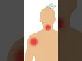 Download Lagu Heart Attack Symptoms | Chest Pain | Continental Hospitals #heartattack #symptoms #chestpain​