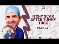Why do I have an Itchy Scar after a Tummy Tuck