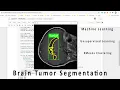 Brain tumour Segmentation