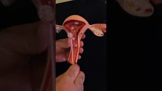 how do we get a uterine endometrial biopsy
