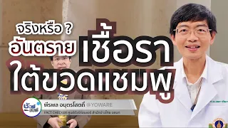 โอกาสที่เชื้อราใต้ขวดแชมพูจะทำให้เกิดโรคในมนุษย์มีมากแค่ไหน และต้องมีปัจจัยอะไรบ้าง