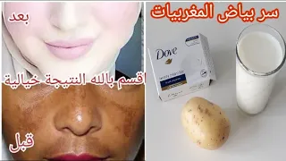 والله ثم والله أقوى وصفة لتبييض الوجه والجسم من التصبغات لبشرة بيضاء بياض الثلج وصافية صفاء الزجاج 