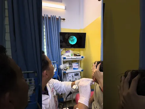 👂 Close-Up Earwax Removal You Won’t Want to Miss! #earcleaning #doctor #shorts