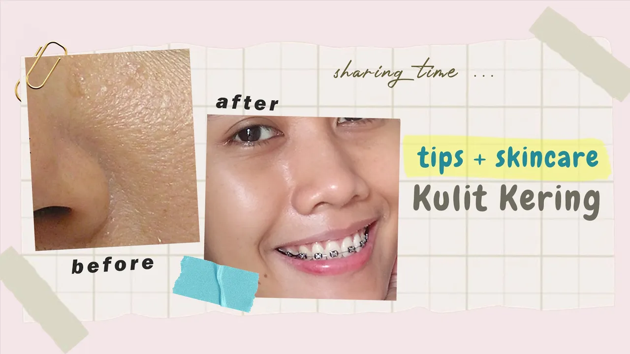 REKOMENDASI SKINCARE UNTUK KULIT KERING & KUSAM [MURAH + AMAN] #wulanhusna. 