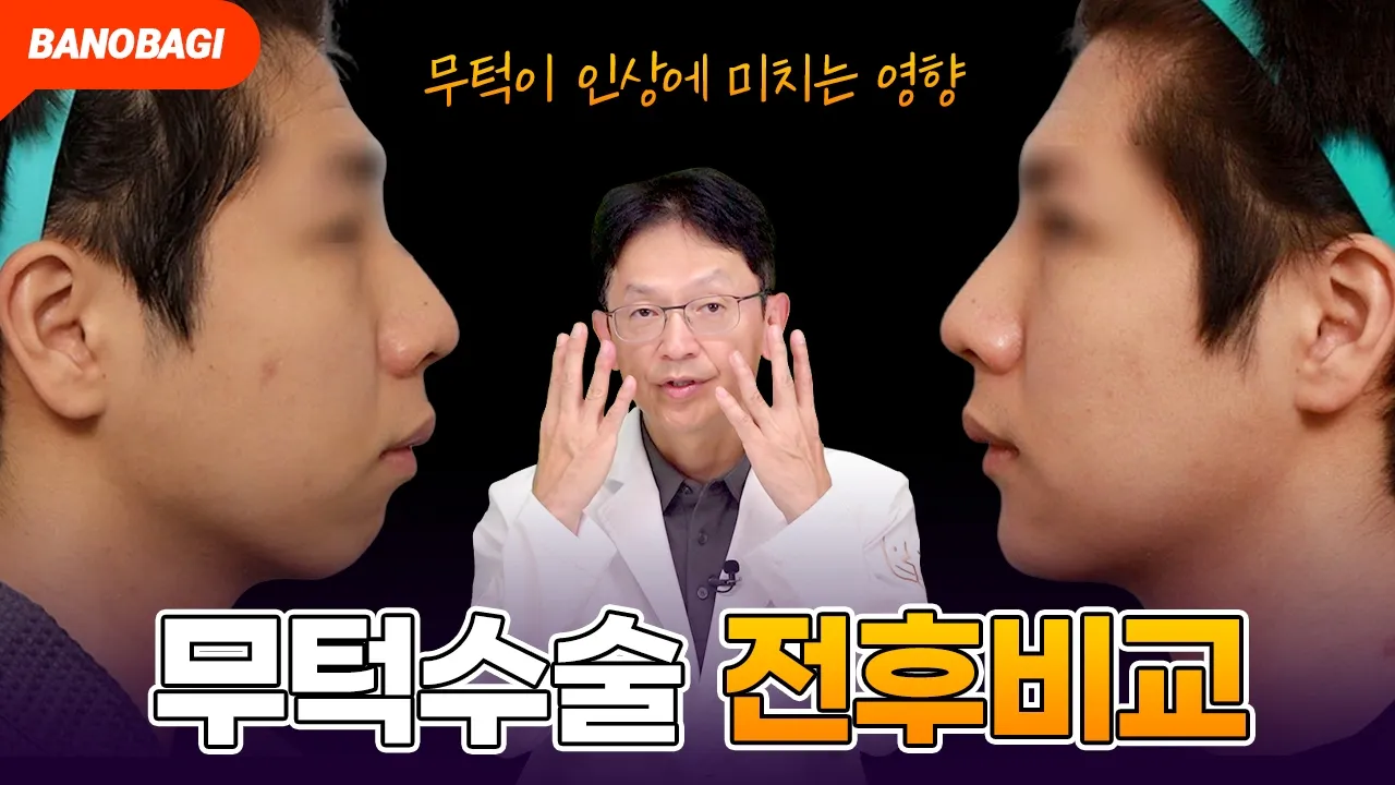 케이스 리뷰로 알아보는 무턱수술&무턱교정🧏🏻♂️