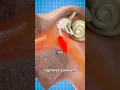 Can Holding In A Sneeze Hurt You Surgeon Reacts