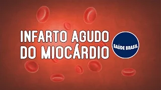 INFARTO AGUDO DO MIOCÁRDIO | SÉRIE SAÚDE BRASIL