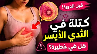 كتلة في الثدي الأيسر قبل الدورة
